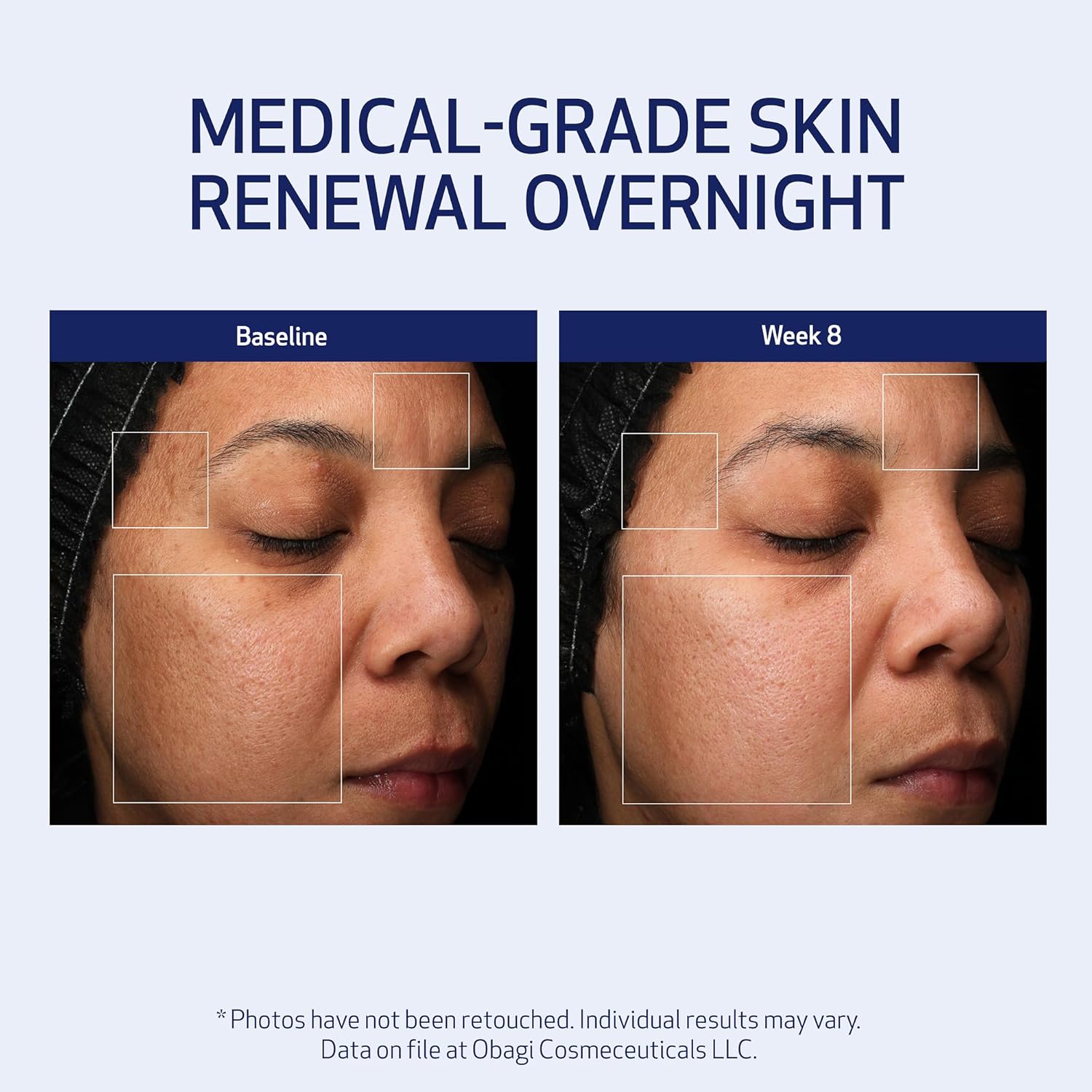 Obagi Medical Retinol + PHA Refining Night Cream