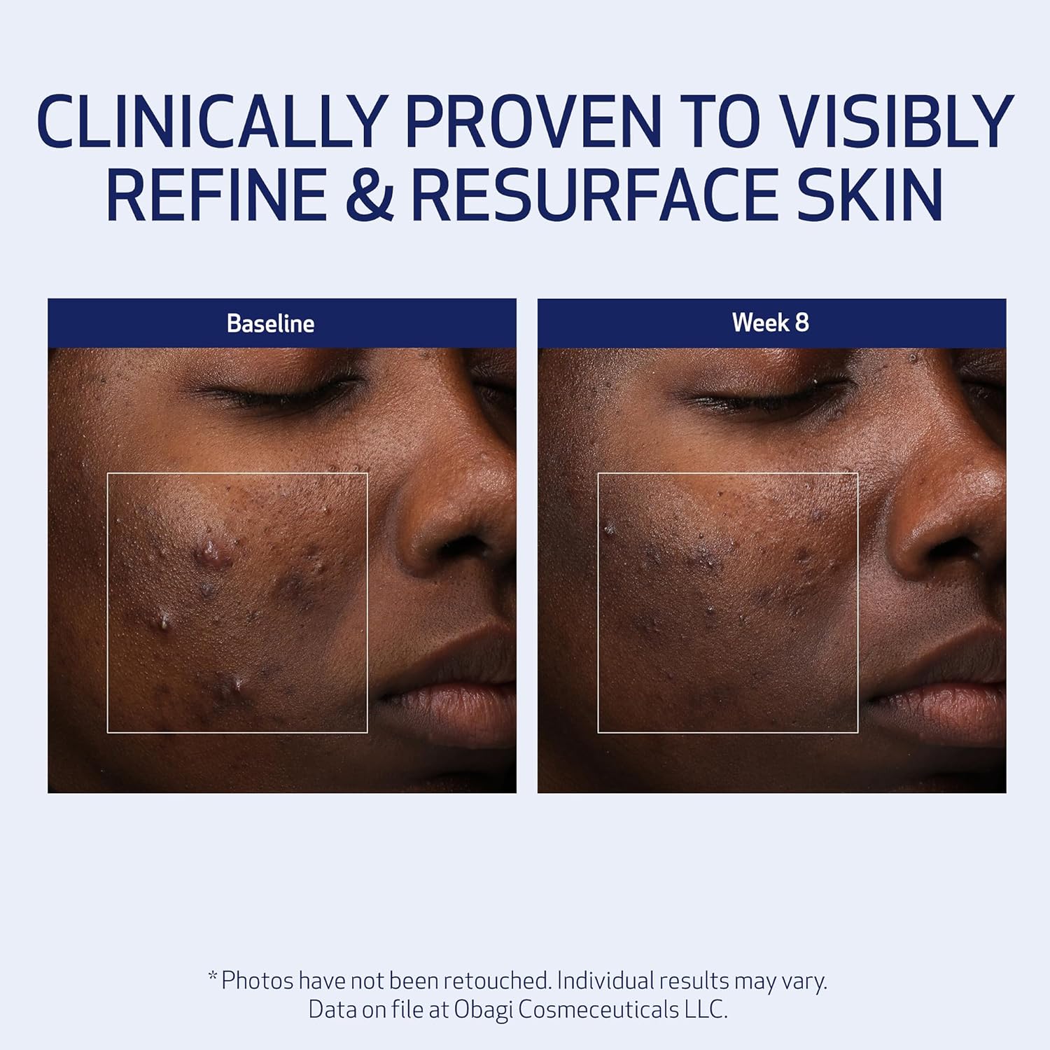 Obagi Medical Retinol + PHA Refining Night Cream