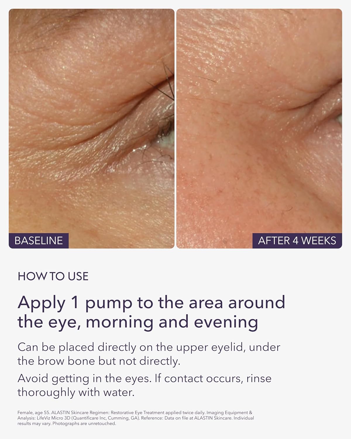 Alastin Restorative Eye Treatment with TriHex Technology® .5 oz