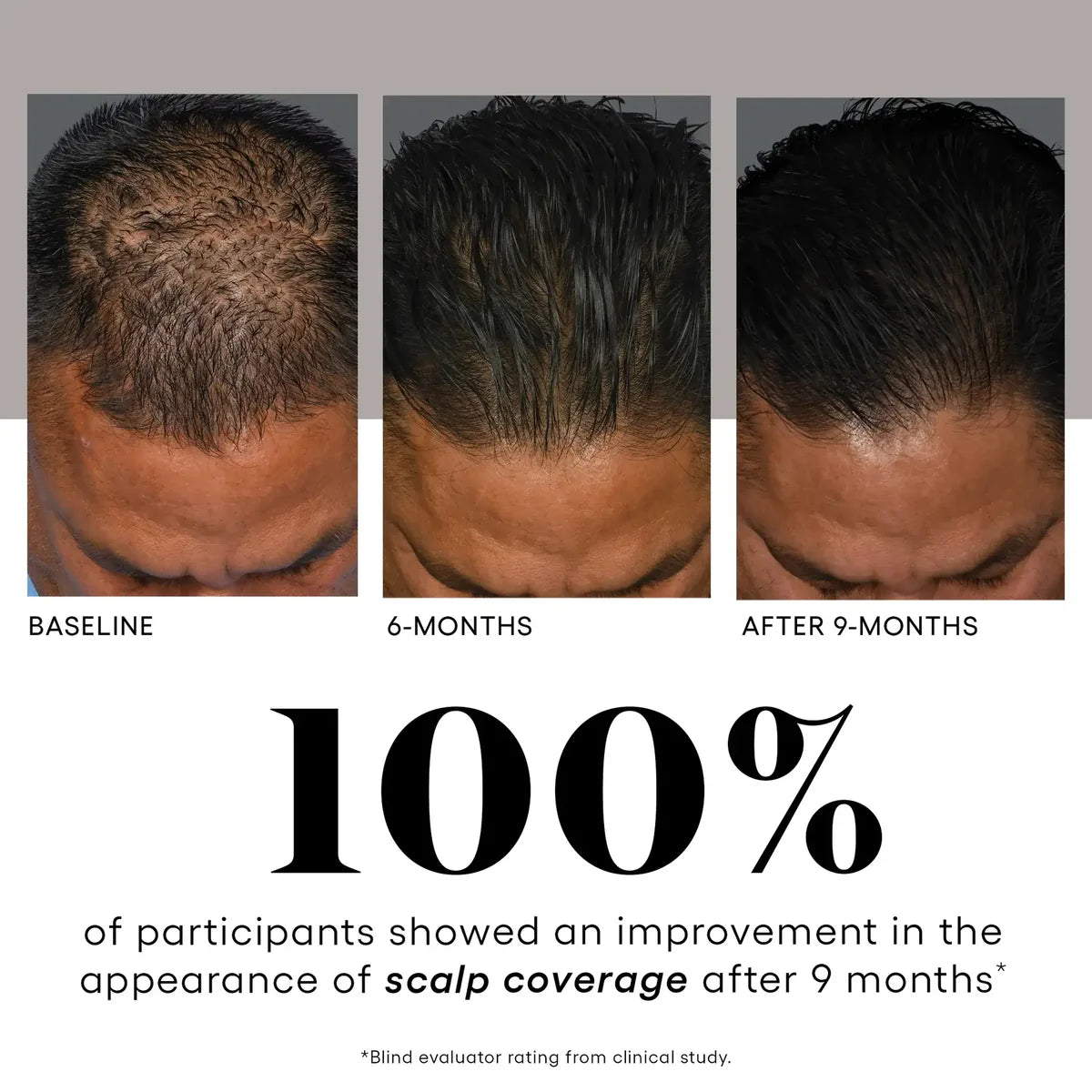Plated™ Hair Serum