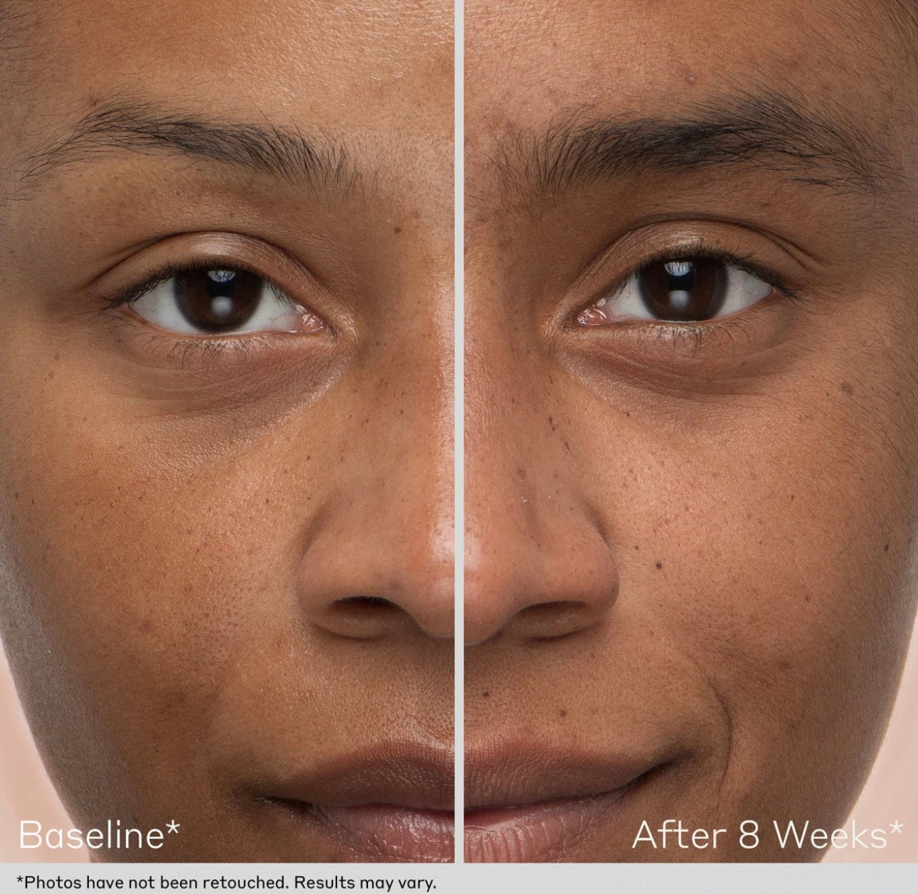 Obagi® Lash and Brow Serum Kit