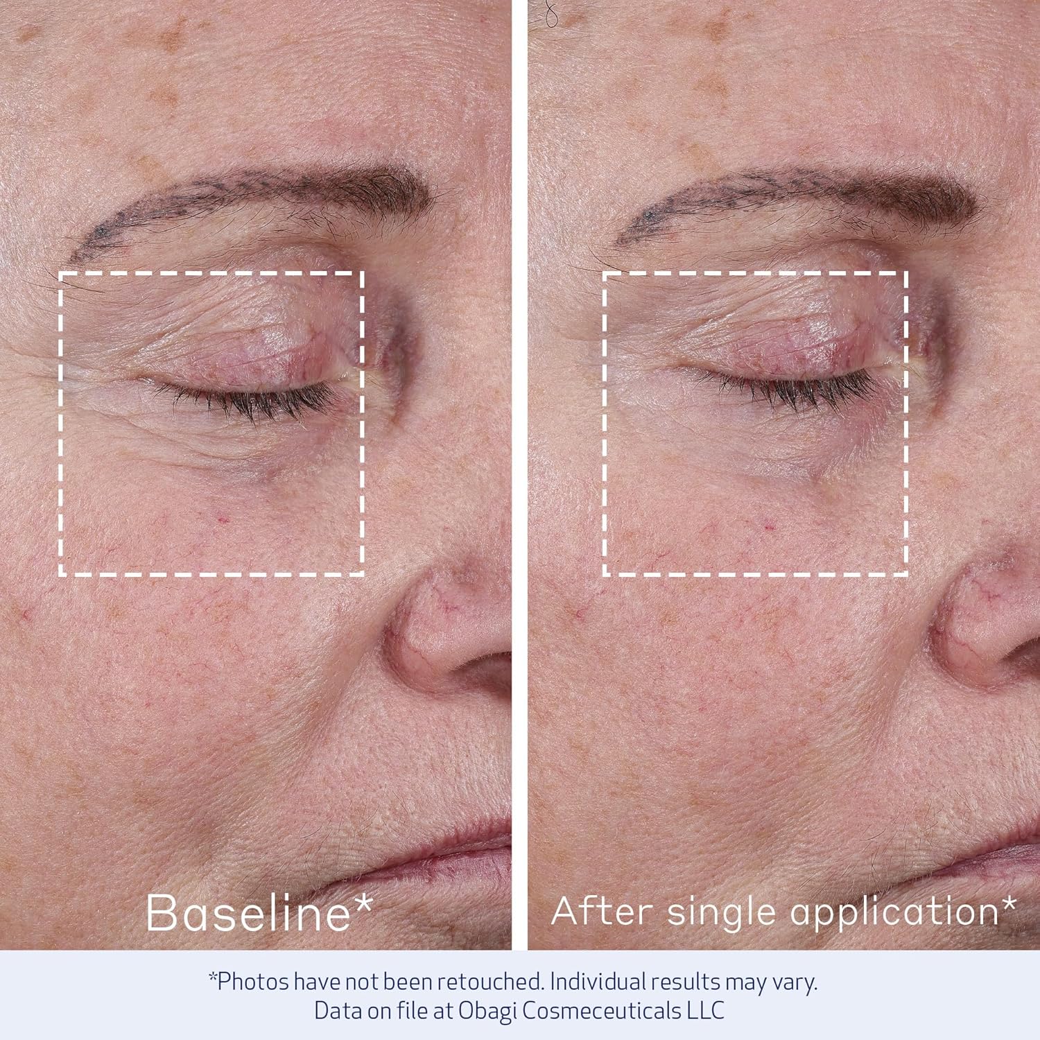 Obagi Elastiderm® Advanced Filler Concentrate