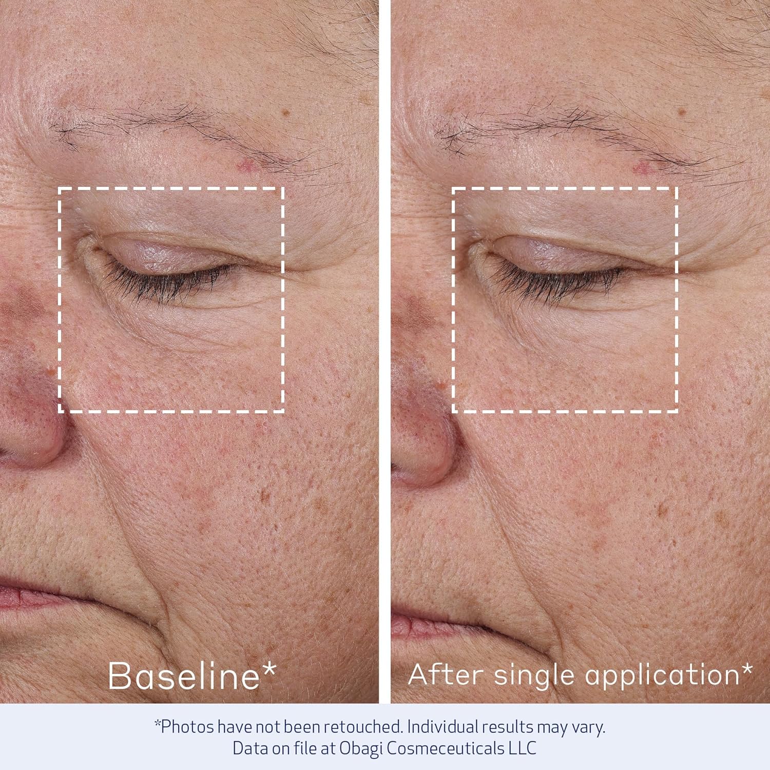 Obagi Elastiderm® Advanced Filler Concentrate