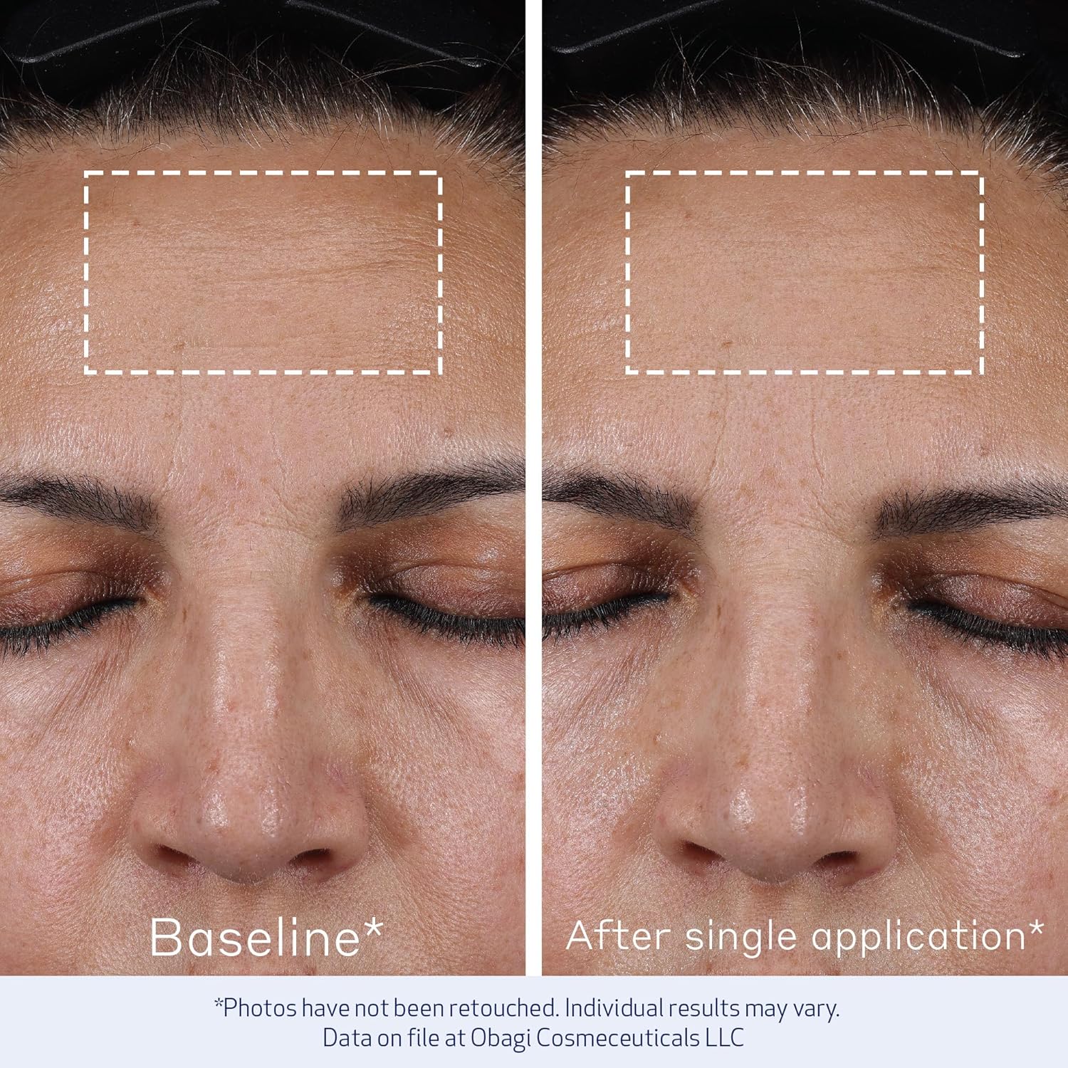 Obagi Elastiderm® Advanced Filler Concentrate