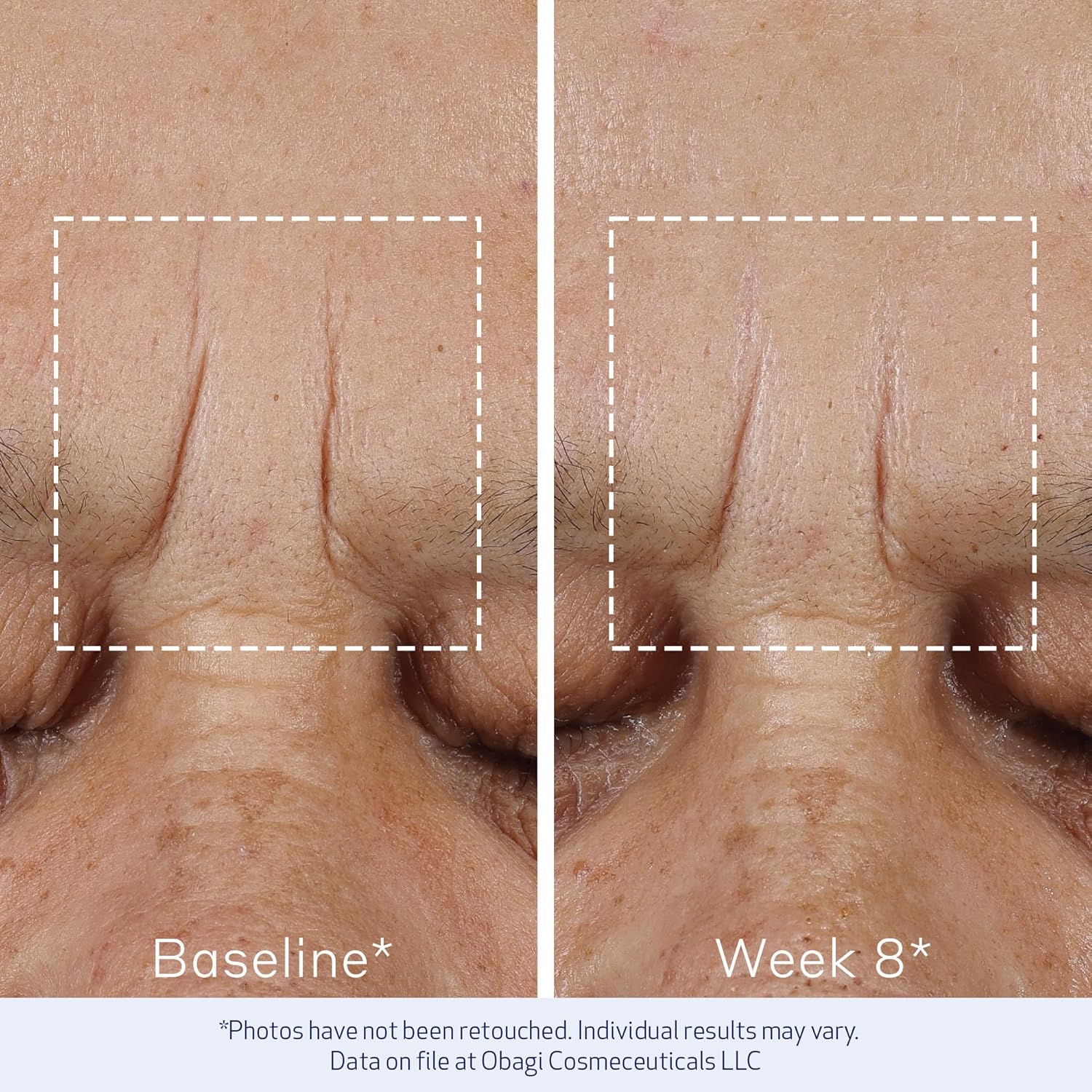 Obagi Elastiderm® Advanced Filler Concentrate