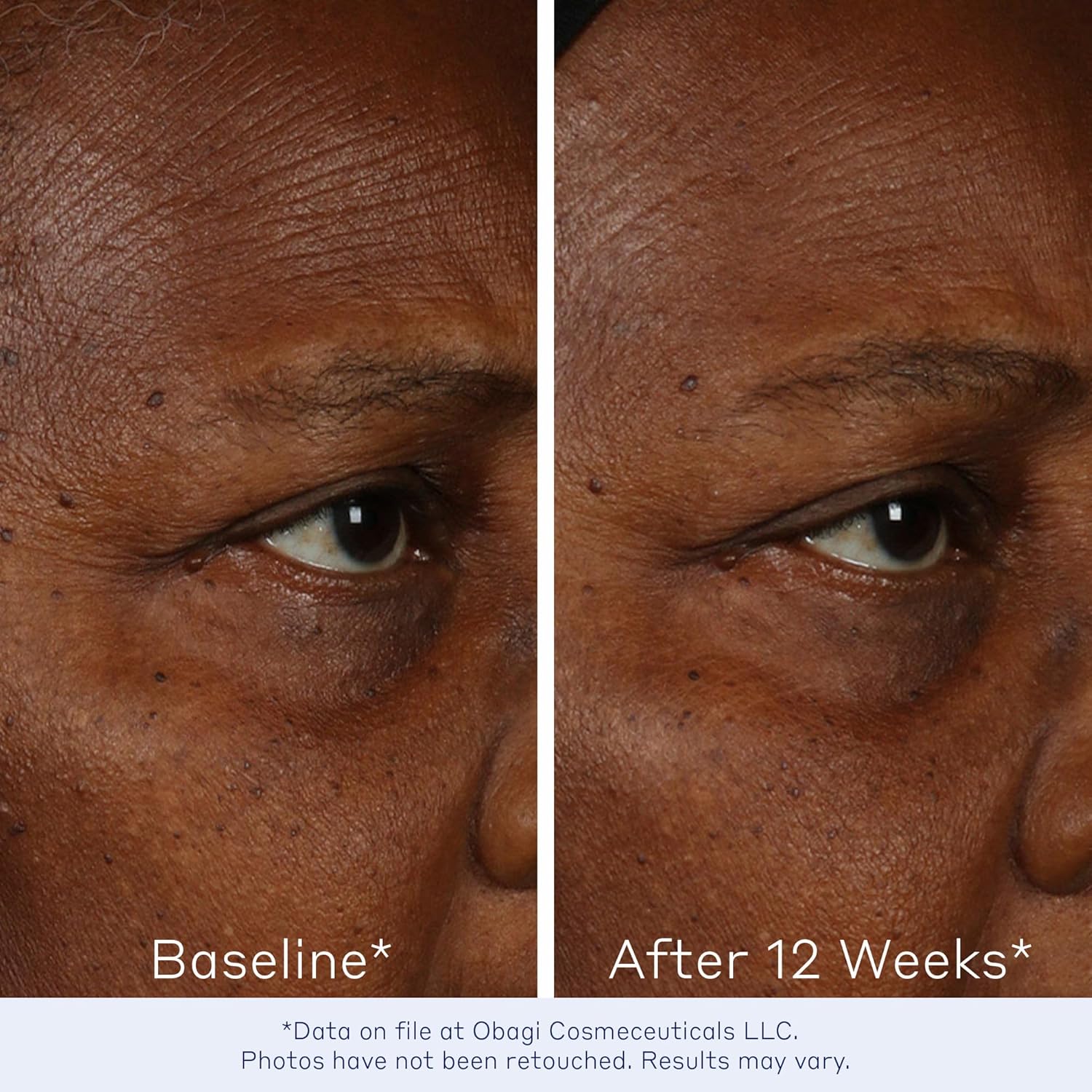 Obagi Elastiderm Facial Serum