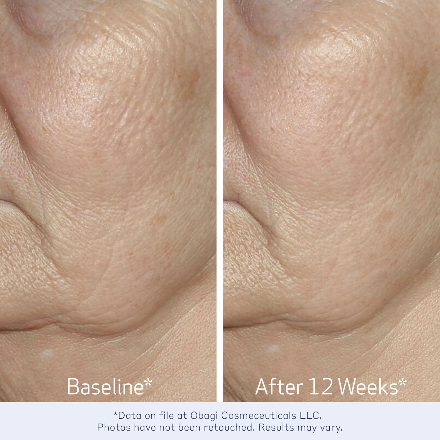 Obagi Elastiderm Facial Serum