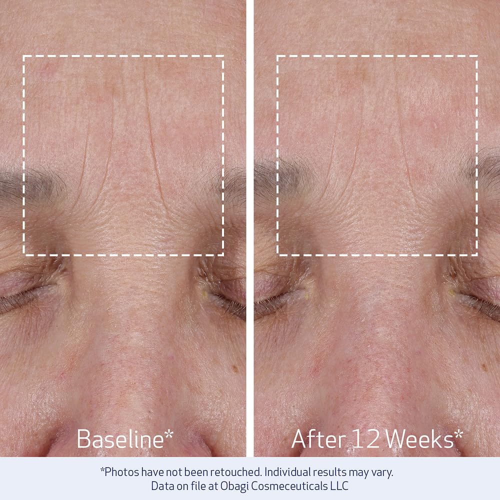 Obagi Elastiderm Lift Up &amp; Sculpt Facial Moisturizer