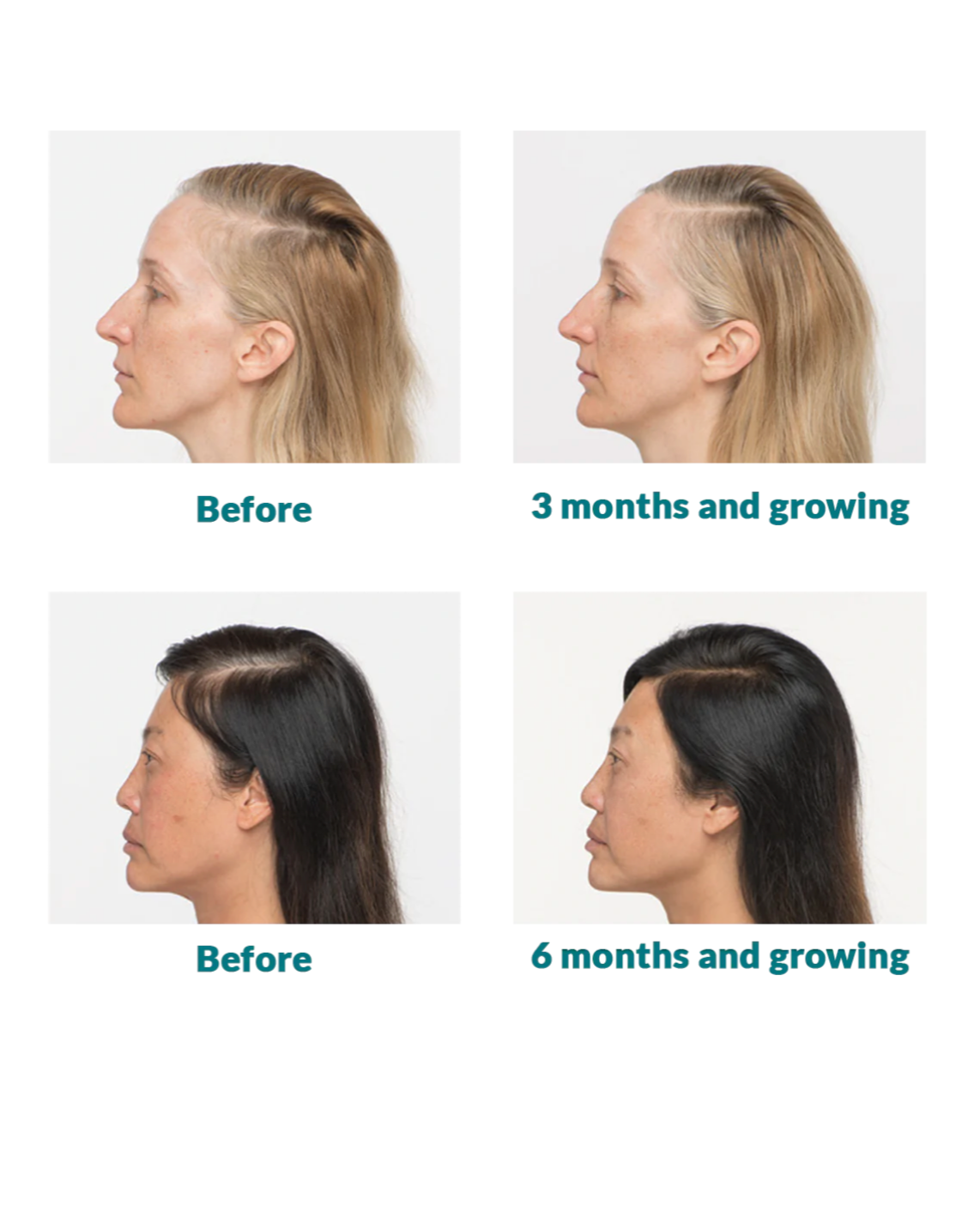 Nutrafol Women's Vegan Growth Pack