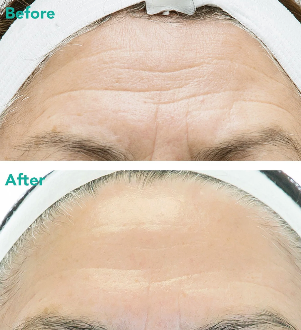 Rejuran Advanced Anti-Aging Retinol + c-PDRN® Serum