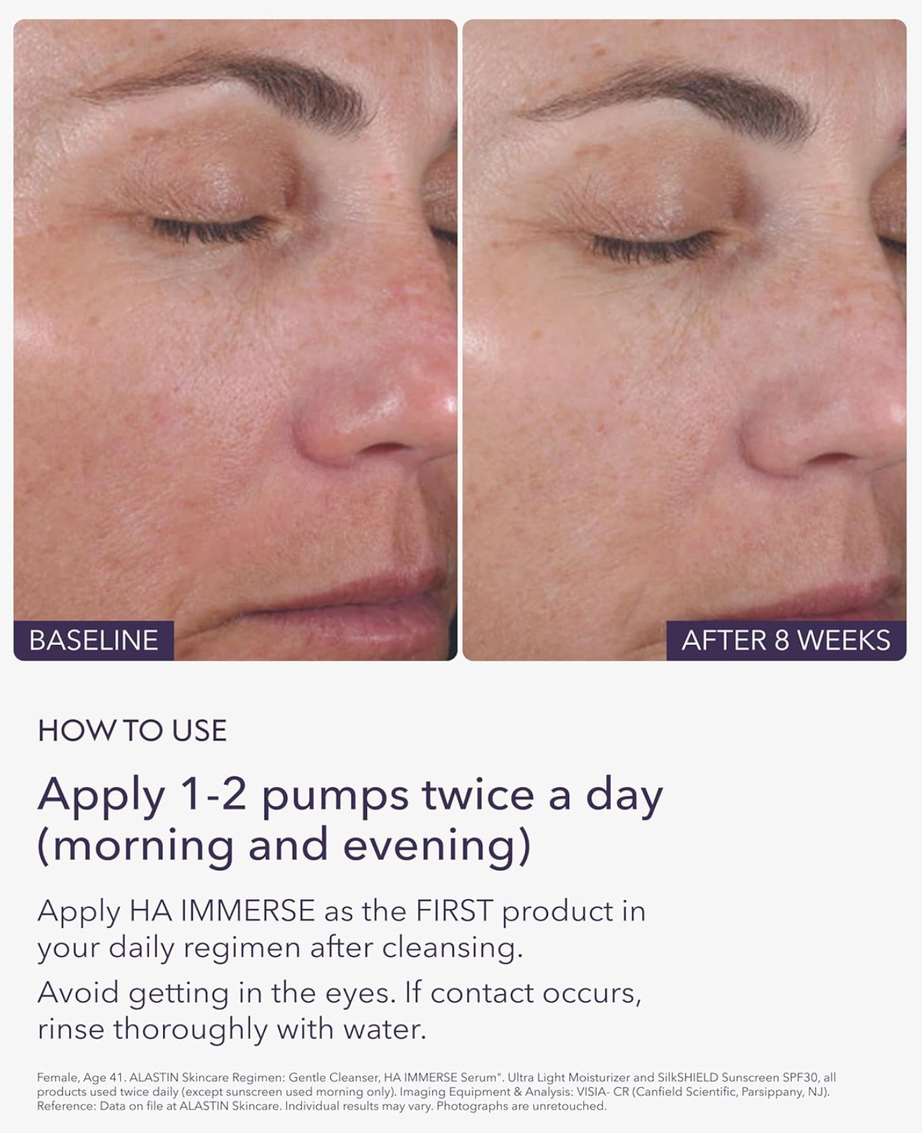 Alastin HA (Hyaluronic Acid) IMMERSE Serum™