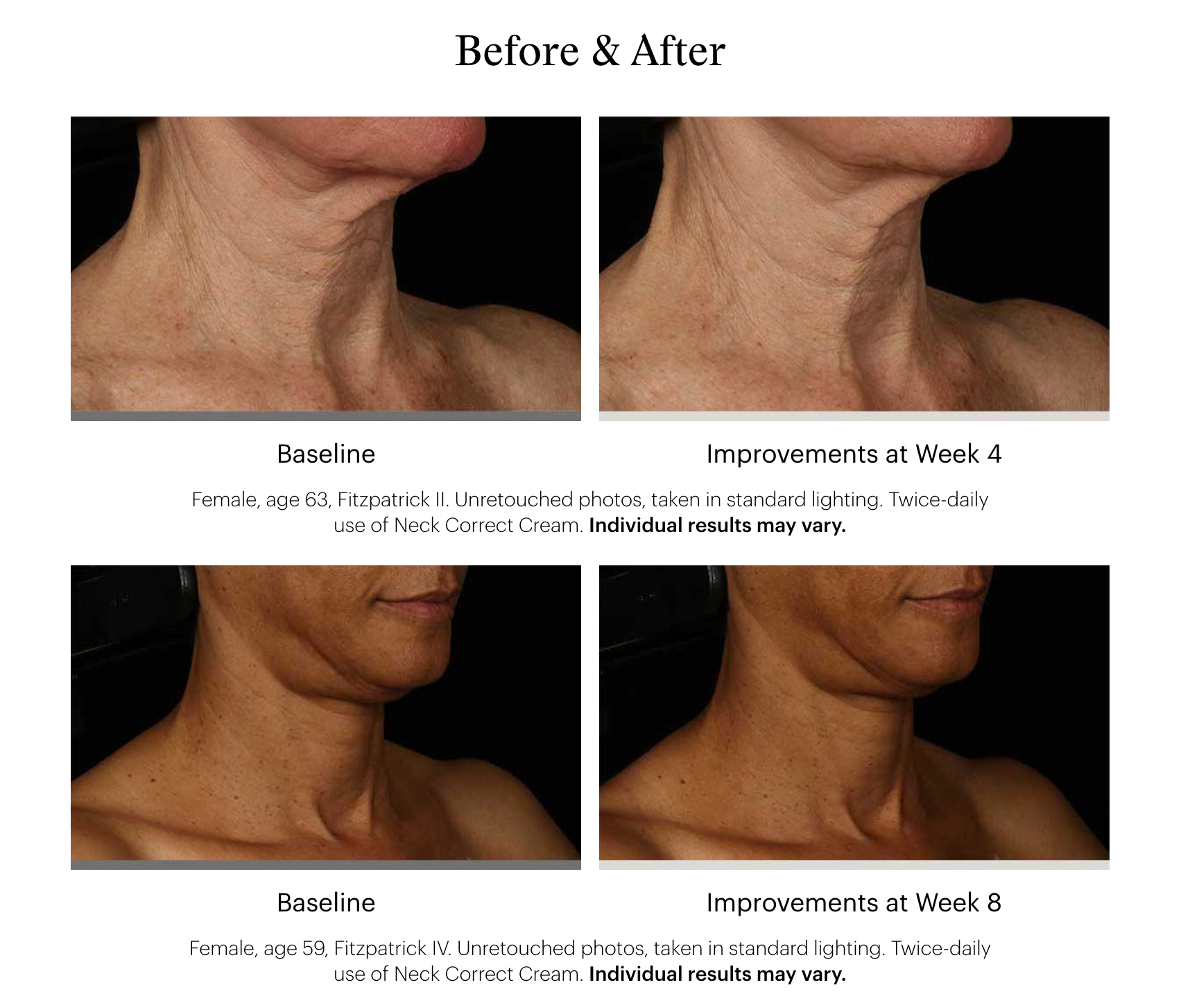 SkinMedica Neck Correct Cream
