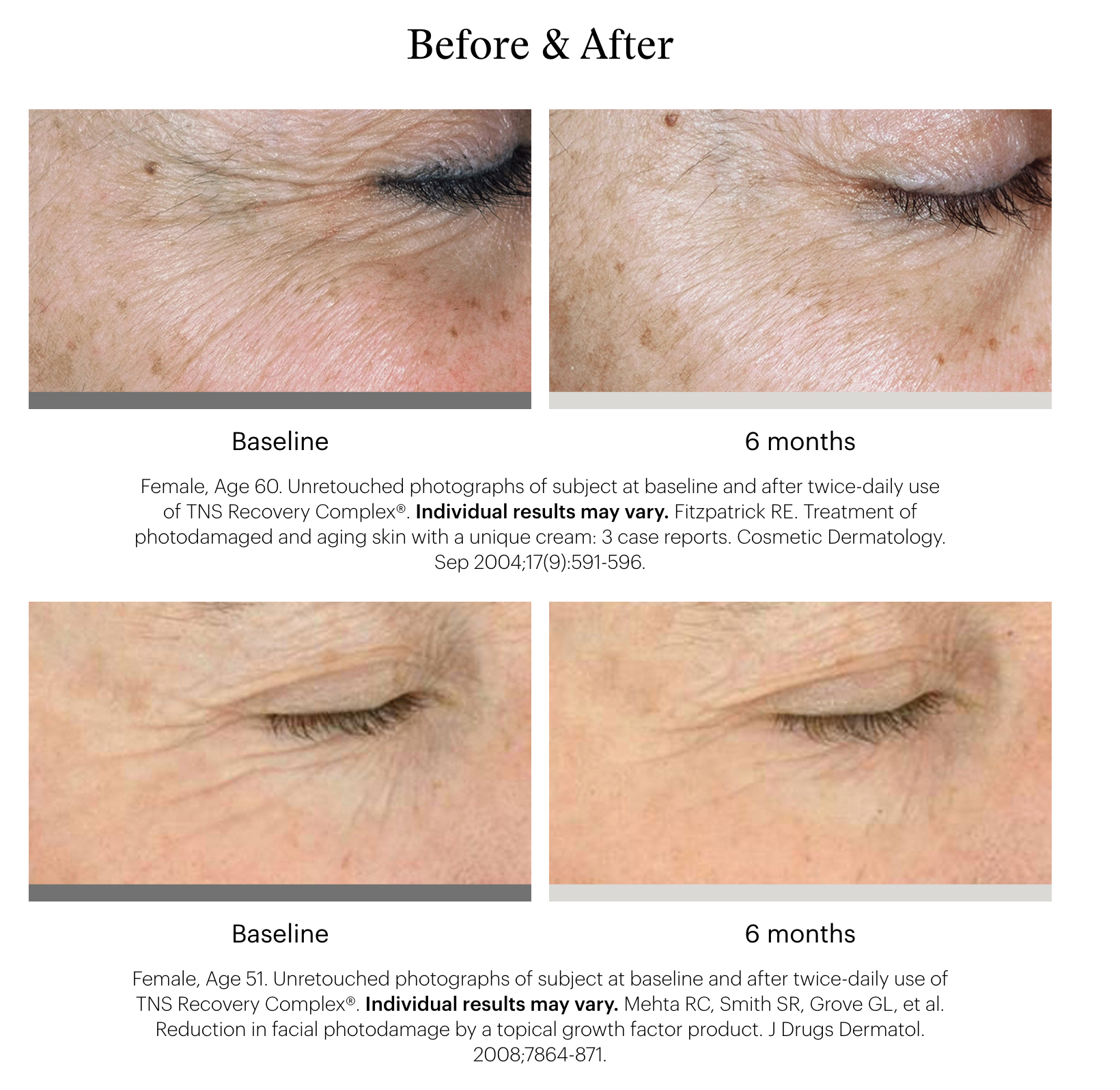 SkinMedica TNS Recovery Complex®
