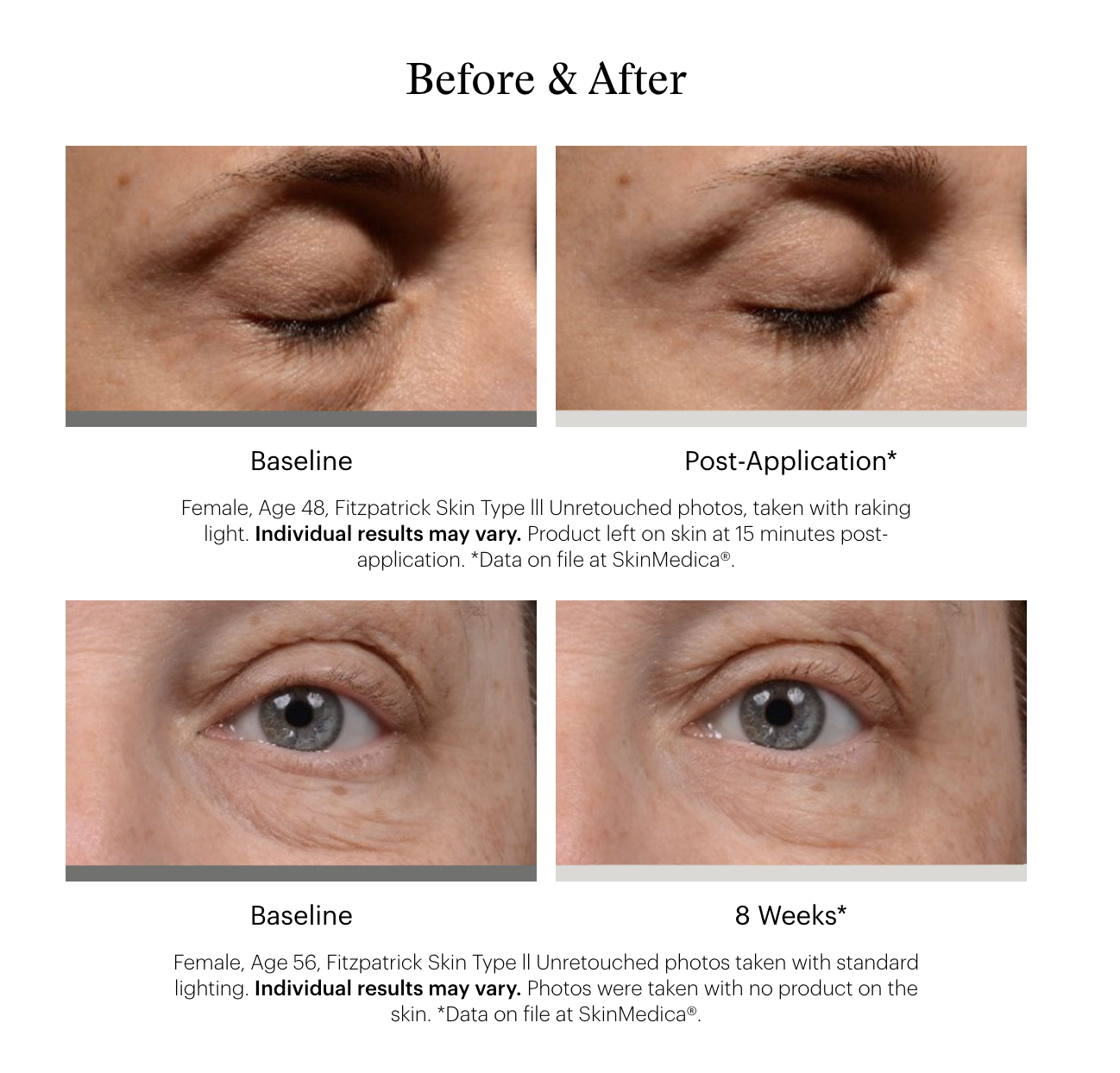 SkinMedica Instant Bright Eye Cream