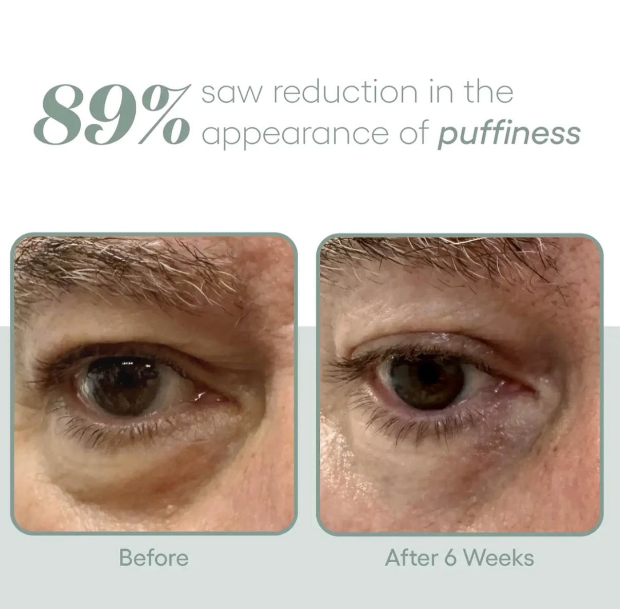 (Plated) Skin Science Eye Serum