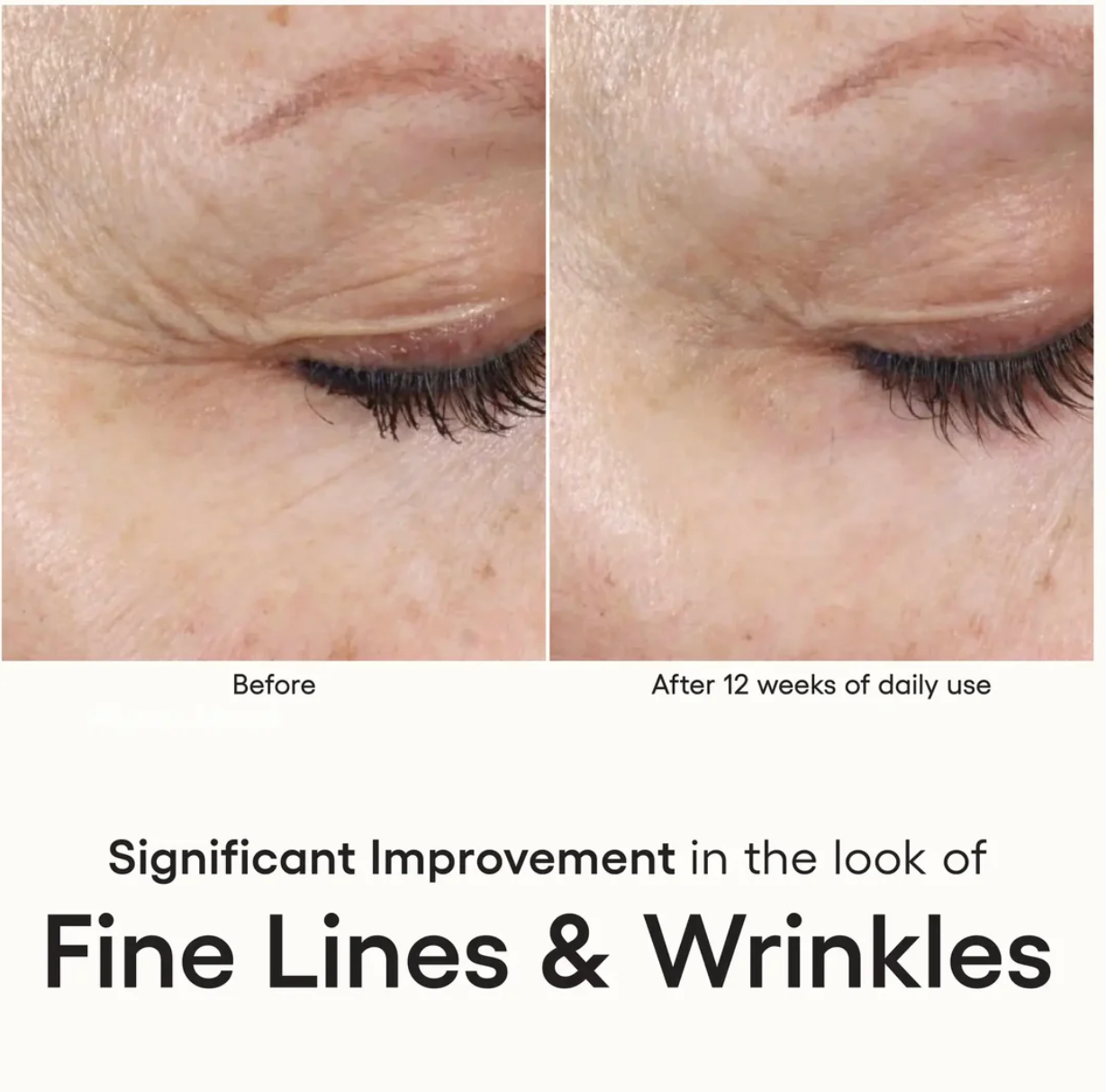 (Plated) Skin Science Intense Serum