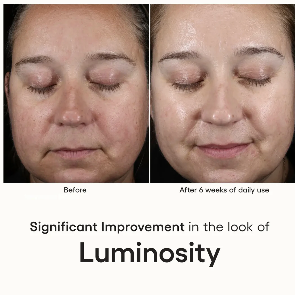 (Plated) Skin Science Intense Serum