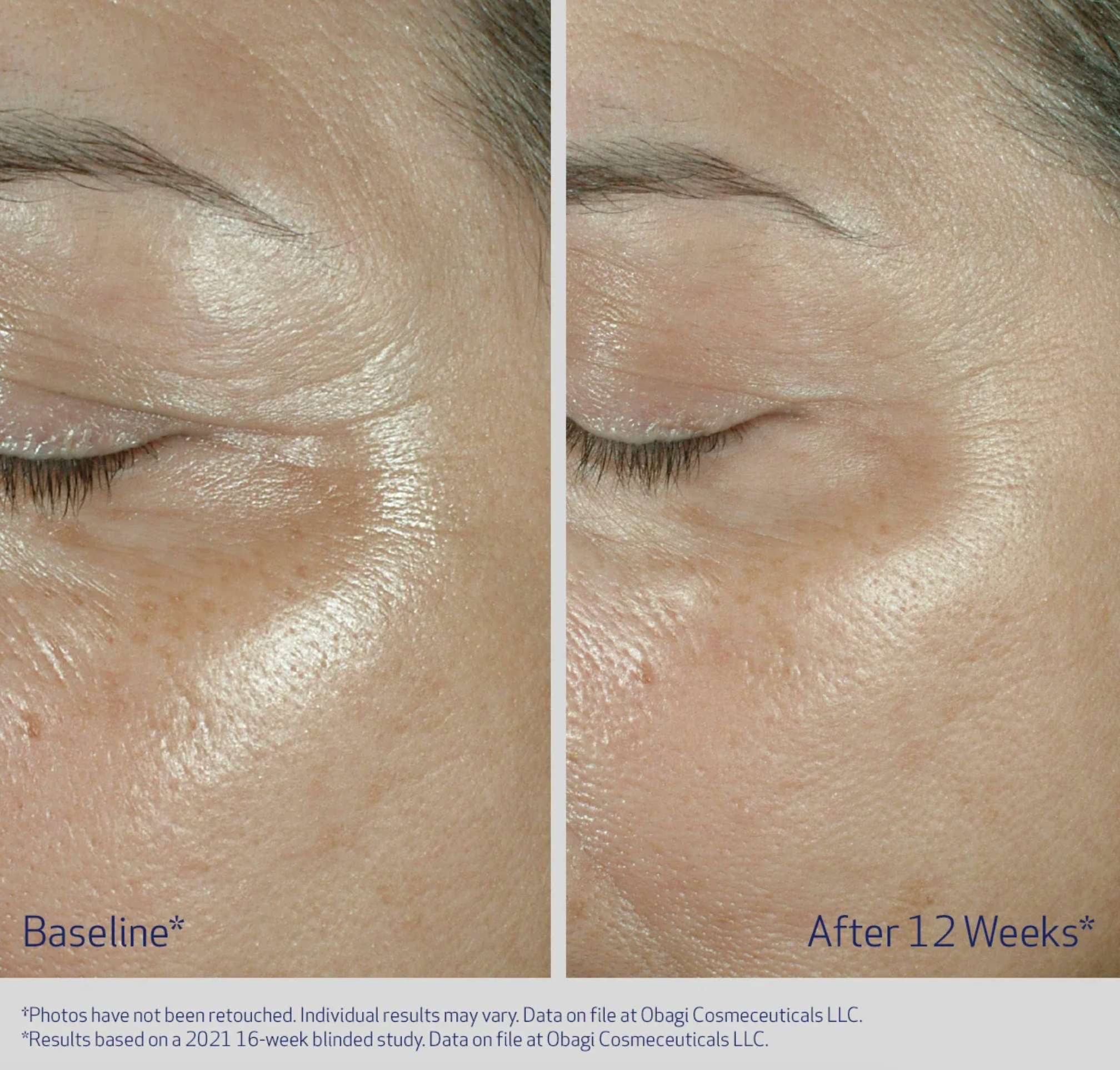 Obagi Elastiderm Eye Cream for Fine Lines & Wrinkles