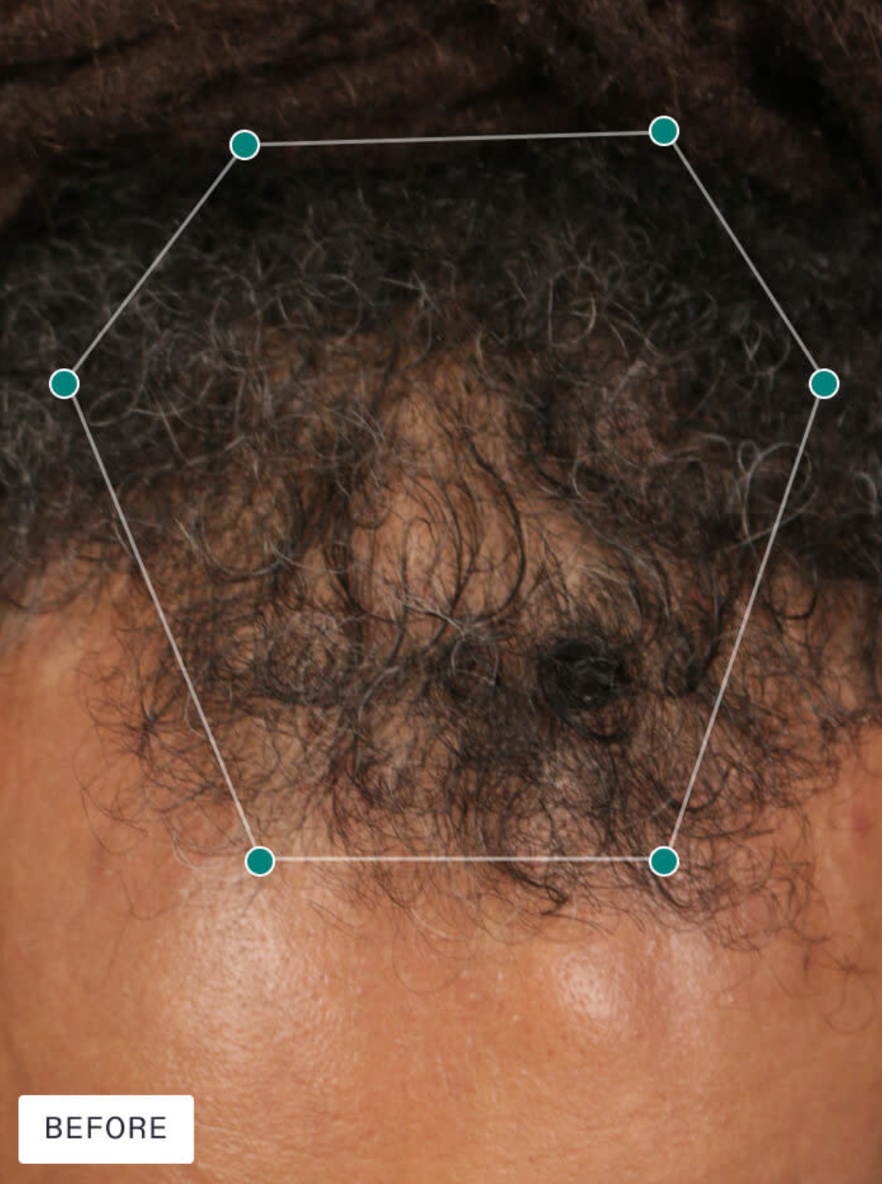 Nutrafol Men's Growth Pack