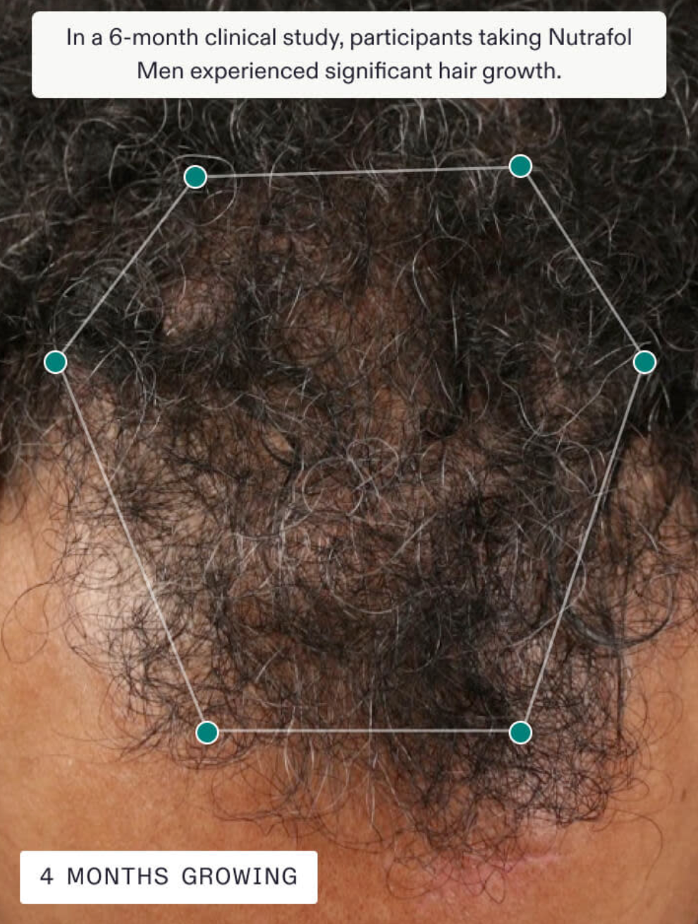 Nutrafol Men's Growth Pack