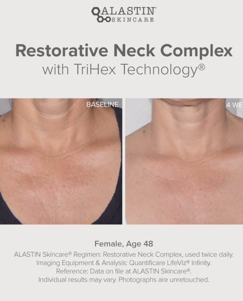 Trihex Technology Alastin Restorative Neck Complex with TriHex Technology® – Aesthetics ...