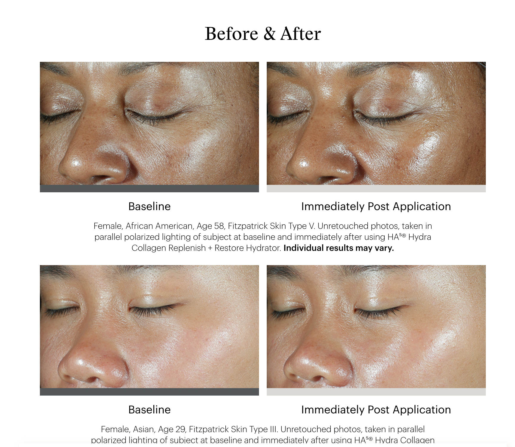 Skin Medica HA⁵® Hydra Collagen Replenish + Restore Hydrator