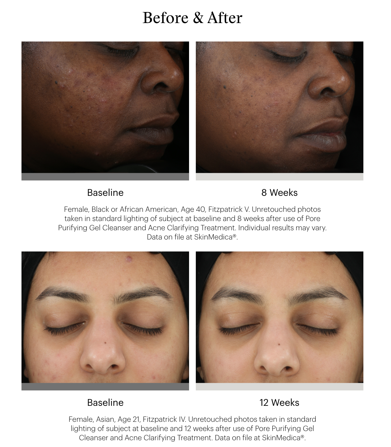 SkinMedica Pore Purifying Gel Cleanser